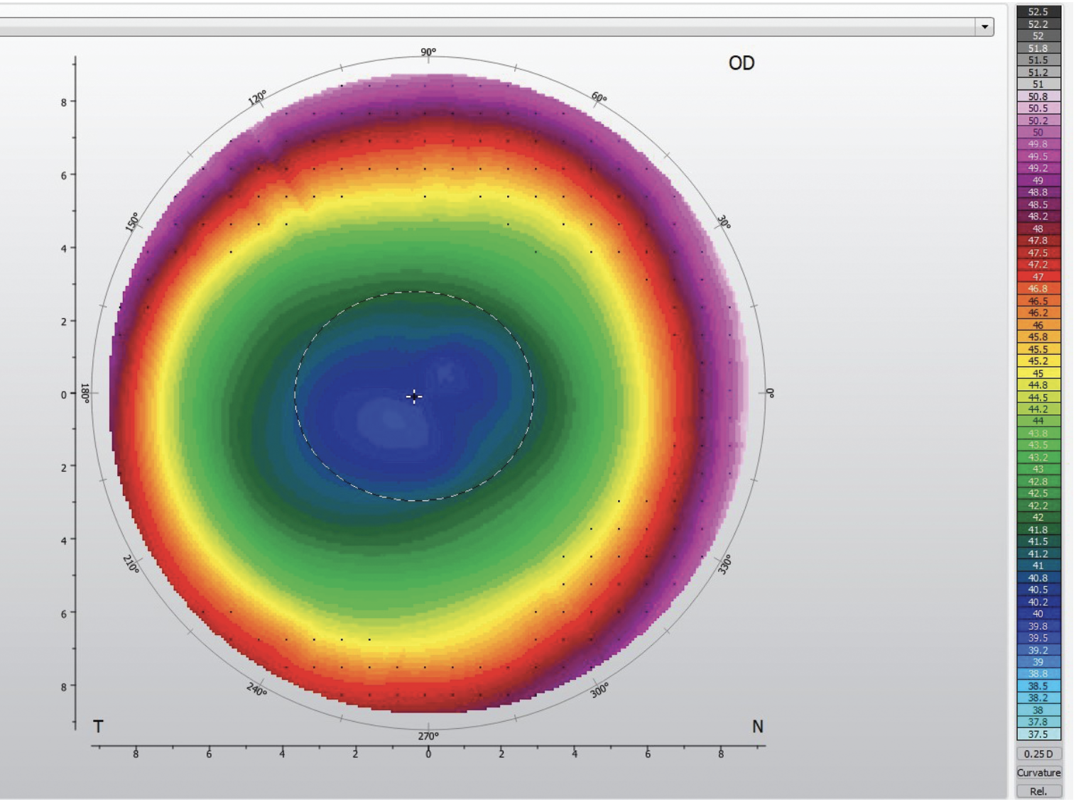Fig. 1. Topography of a center-distance aspheric corneal GP. Aspheric lenses often employ a center-distance zone that gradually increases in power to a near peripheral zone.