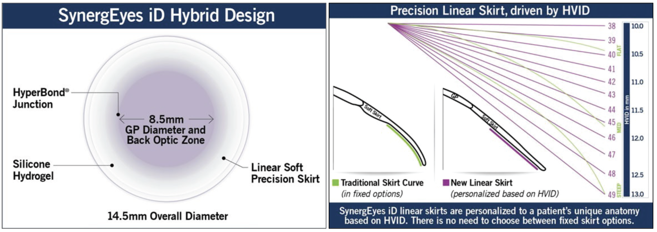 Fig. 2. SynergEyes iD MF EDOF design is fit empirically based on HVID, corneal curvature and refractive error. The linear skirt, personalized for each lens, promotes oxygen permeability and reduces the risk of tight lens syndrome.