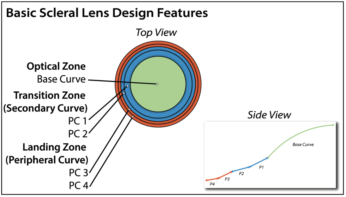 Fig. 1. Most scleral lenses share these common design features.